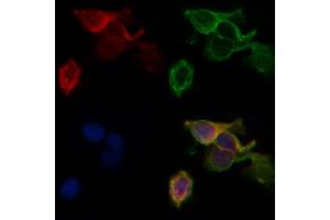 ABIN6260492 and ABIN6268884 staining HepG2 by IF/ICC. (CTNNA1 Antikörper  (C-Term))