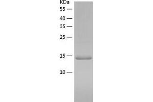 Western Blotting (WB) image for Nudix (Nucleoside Diphosphate Linked Moiety X)-Type Motif 1 (NUDT1) (AA 1-156) protein (His tag) (ABIN7124237) (NUDT1 Protein (AA 1-156) (His tag))