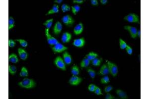 Immunofluorescence staining of Hela cells with ABIN7151301 at 1:200, counter-stained with DAPI. (Zinc Finger Protein 650 (ZNF650) (AA 960-1113) Antikörper)