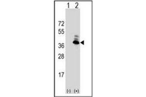 Image no. 5 for anti-Aspartoacylase (ASPA) (AA 89-118), (N-Term) antibody (ABIN452768) (ASPA Antikörper  (N-Term))