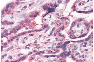 Human Placenta (formalin-fixed, paraffin-embedded) stained with TFF2 antibody ABIN351426 at 15 ug/ml followed by biotinylated goat anti-rabbit IgG secondary antibody ABIN481713, alkaline phosphatase-streptavidin and chromogen. (Trefoil Factor 2 Antikörper  (Internal Region))