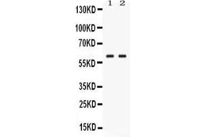 Western blot analysis of GPI expression in human placenta extract ( Lane 1) and JURKAT whole cell lysates ( Lane 2).