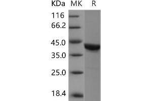 Western Blotting (WB) image for Casein Kinase 2 alpha 1 (CSNK2A1) protein (ABIN7320134)