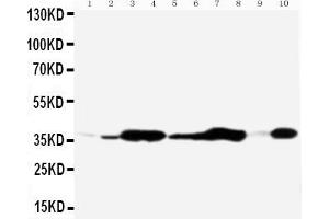 Western Blotting (WB) image for anti-Annexin A5 (ANXA5) (AA 88-102), (Middle Region) antibody (ABIN3044315)