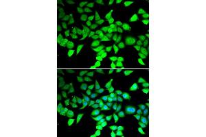 Immunofluorescence analysis of MCF-7 cells using HDAC7 antibody. (HDAC7 Antikörper)