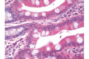 Anti-WC1 / ATP7B antibody IHC staining of human small intestine.