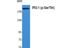 Western Blot (WB) analysis of specific cells using Phospho-IRS-1 (S794) Polyclonal Antibody.