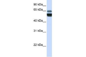 SMPD1 antibody used at 1 ug/ml to detect target protein. (SMPD1 Antikörper  (Middle Region))