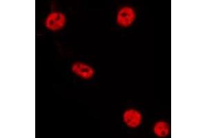 ABIN6275549 staining HepG2 by IF/ICC. (PPP2R3B Antikörper  (Internal Region))