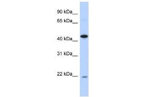 Western Blotting (WB) image for anti-RNA-Binding Protein NOB1 (NOB1) antibody (ABIN2459838) (NOB1 Antikörper)