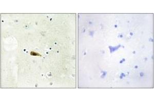 Immunohistochemistry analysis of paraffin-embedded human brain tissue, using MYST1 Antibody. (MYST1 Antikörper  (AA 101-150))