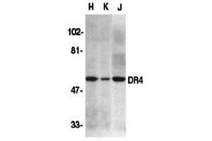Western Blotting (WB) image for anti-Drought-Repressed 4 Protein (DR4) (N-Term) antibody (ABIN1031359) (DR4 Antikörper  (N-Term))