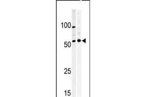Western blot analysis of anti-PKMYT1 Pabin A375(left) and Y79 (right)cell line lysate.