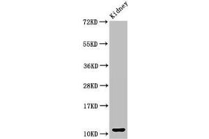 Western Blot Positive WB detected in: Mouse kidney tissue All lanes: CCL3 antibody at 3 μg/mL Secondary Goat polyclonal to rabbit IgG at 1/50000 dilution Predicted band size: 11 kDa Observed band size: 11 kDa (CCL3 Antikörper  (AA 25-81))