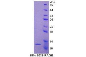 SDS-PAGE (SDS) image for Peroxisomal Biogenesis Factor 2 (PEX2) (AA 233-305) protein (His tag) (ABIN1878645)