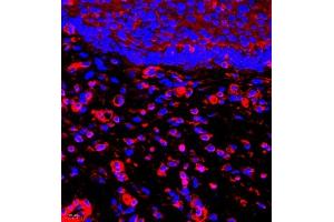 Immunofluorescence (Paraffin-embedded Sections) (IF (p)) image for anti-Myosin Light Chain 6, Alkali, Smooth Muscle and Non Muscle (MYL6) antibody (ABIN7074734)