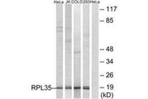 Western blot analysis of extracts from 293/HeLa/COLO/Jurkat cells, using RPL35 Antibody. (RPL35 Antikörper  (AA 51-100))