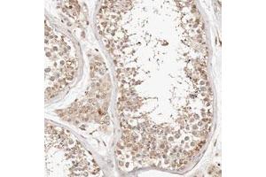 Immunohistochemical staining (Formalin-fixed paraffin-embedded sections) of human testis with KIF9 polyclonal antibody  shows moderate cytoplasmic positivity in cells in seminiferous ducts and Leydig cells.