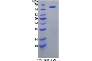 SDS-PAGE (SDS) image for Fibrinogen beta Chain (FGB) (AA 29-491) protein (His tag) (ABIN1079523) (Fibrinogen beta Chain Protein (FGB) (AA 29-491) (His tag))