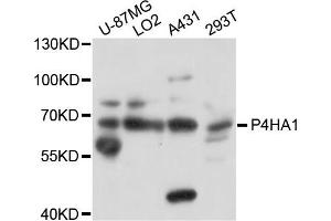 Western blot analysis of extracts of various cells, using P4HA1 antibody. (P4HA1 Antikörper)