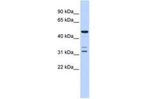 Image no. 1 for anti-HtrA Serine Peptidase 4 (HTRA4) (AA 396-445) antibody (ABIN6741359) (HTRA4 Antikörper  (AA 396-445))
