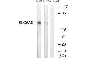 Western blot analysis of extracts from HepG2 cells and HUVEC cells, using SLC5A6 antibody.
