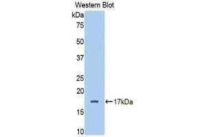 Western blot analysis of the recombinant protein. (Complement Factor B Antikörper  (AA 477-600))