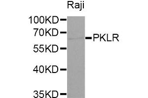 Western blot analysis of extracts of Raji cells, using PKLR antibody (ABIN5970989) at 1/1000 dilution. (PKLR Antikörper)