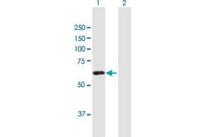 Western Blot analysis of ZSCAN21 expression in transfected 293T cell line by ZSCAN21 MaxPab polyclonal antibody. (ZSCAN21 Antikörper  (AA 1-473))