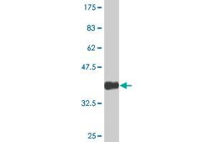 Western Blot detection against Immunogen (36. (AGPAT6 Antikörper  (AA 39-137))