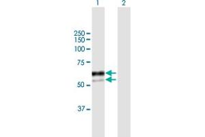 Western Blot analysis of SNX8 expression in transfected 293T cell line by SNX8 MaxPab polyclonal antibody. (SNX8 Antikörper  (AA 1-465))