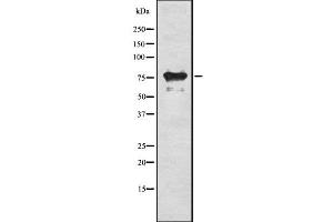 Western blot analysis of RIPK1 using HeLa whole cell lysates (RIPK1 Antikörper  (Internal Region))