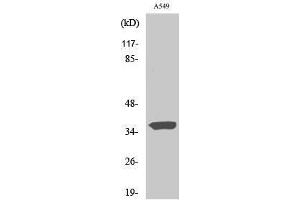 Western Blotting (WB) image for anti-Six Transmembrane Epithelial Antigen of The Prostate 1 (STEAP1) (N-Term) antibody (ABIN3187095) (STEAP1 Antikörper  (N-Term))