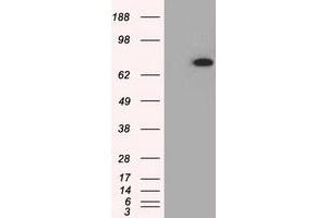 HEK293T cells were transfected with the pCMV6-ENTRY control (Left lane) or pCMV6-ENTRY PDE4A (Right lane) cDNA for 48 hrs and lysed. (PDE4A Antikörper)