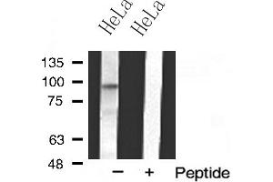 Western blot analysis of MKL1 expression in HeLa cell extract (MKL1 Antikörper  (N-Term))