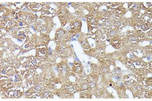 Immunohistochemistry of paraffin-embedded Rat liver using CDK5RAP1 Polyclonal Antibody at dilution of 1:100 (40x lens). (CDK5RAP1 Antikörper)