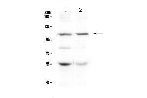 Western blot analysis of DPYD using anti-DPYD antibody . (DPYD Antikörper  (AA 356-511))