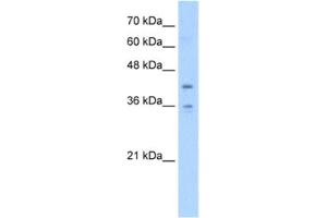 Western Blotting (WB) image for anti-Transmembrane Protein 104 (TMEM104) antibody (ABIN2463056) (TMEM104 Antikörper)