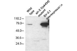 Western blot using Sir2. (Sir2.1 Antikörper)