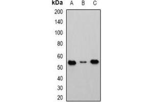 Western blot analysis of Cbl-3 expression in HEK293T (A), Raji (B), mouse kidney (C) whole cell lysates. (CBLC Antikörper)
