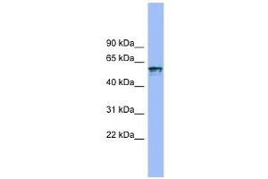 IL18R1 antibody used at 1 ug/ml to detect target protein. (IL18R1 Antikörper  (N-Term))