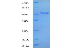 SDS-PAGE (SDS) image for Tryptophan 2,3-Dioxygenase (TDO2) (AA 1-406), (full length) protein (His tag) (ABIN5713878)