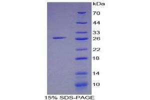 SDS-PAGE (SDS) image for Interferon, gamma-Inducible Protein 16 (IFI16) (AA 465-671) protein (His tag) (ABIN1879668)
