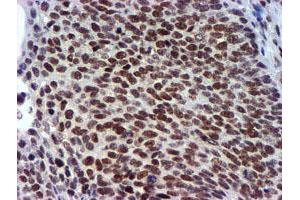 Image no. 5 for anti-Ubiquitin Specific Peptidase 7 (Herpes Virus-Associated) (USP7) antibody (ABIN1498592) (USP7 Antikörper)