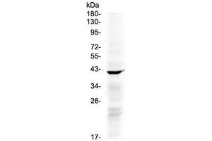 Western blot testing of human COLO320 cell lysate with NDRG3 antibody at 0. (NDRG3 Antikörper)
