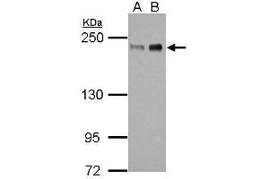 WB Image Sample (30 ug of whole cell lysate) A: 293T B: HeLa 5% SDS PAGE antibody diluted at 1:1000