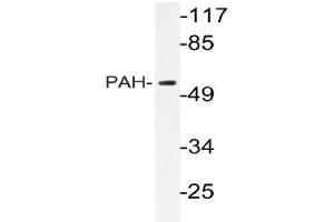 Western blot (WB) analyzes of PAH antibody in extracts from HepG2 cells. (Phenylalanine Hydroxylase Antikörper)