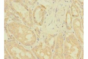 Immunohistochemistry of paraffin-embedded human kidney tissue using ABIN7176445 at dilution of 1:100 (ZNF624 Antikörper  (AA 127-327))