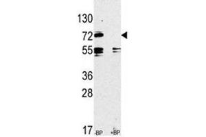 Western blot analysis of anti-TLR2 antibody pre-incubated without and with blocking peptide in CEM lysate