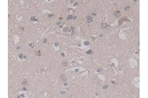 Detection of RALA in Human Cerebrum Tissue using Monoclonal Antibody to V-Ral Simian Leukemia Viral Oncogene Homolog A (RALA) (rala Antikörper  (AA 1-206))